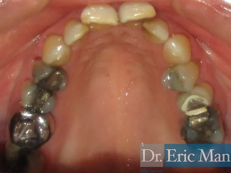 Cosmetica Dental: antes